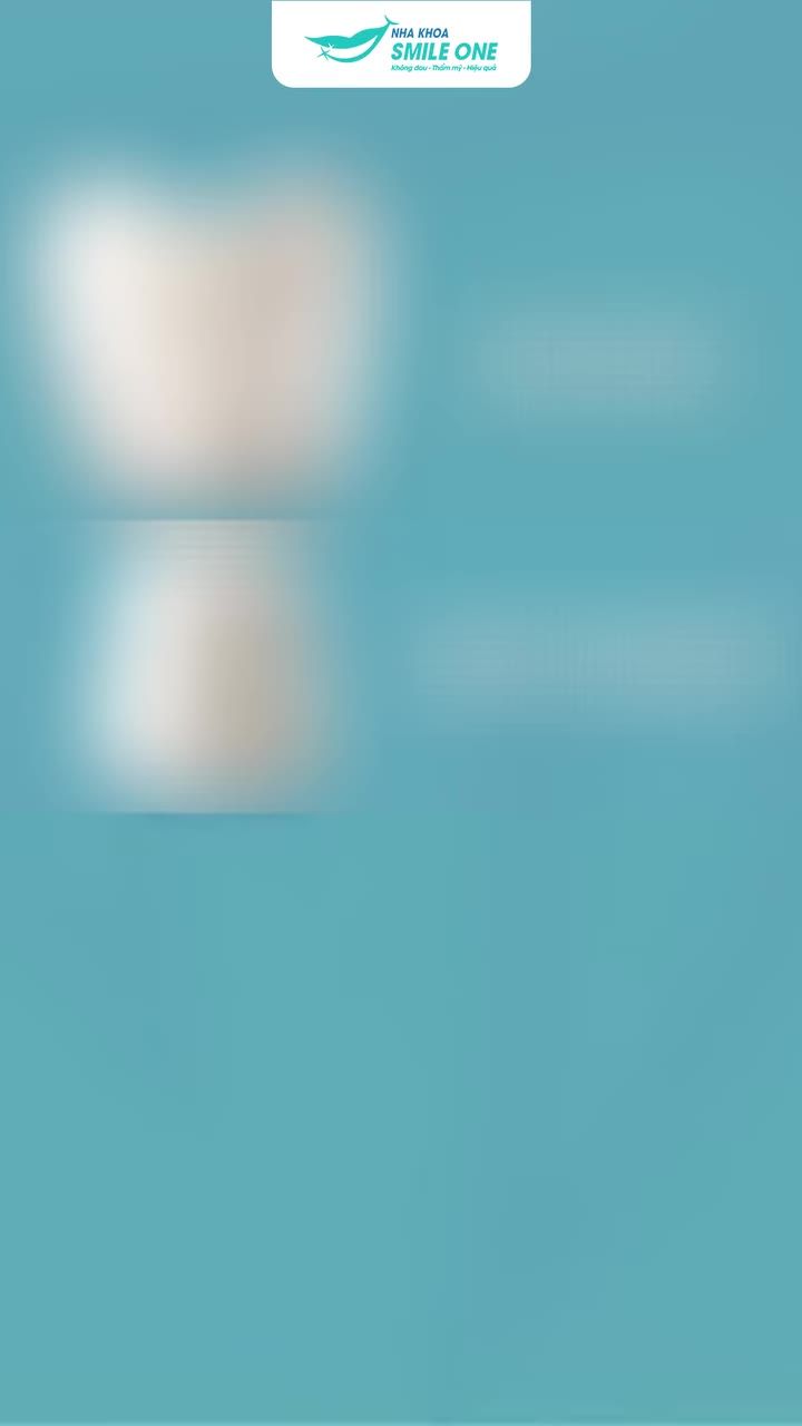 GIẢI MÃ IMPLANT 2 Bạn đã biết cấu tạo của một chiếc "răng Implant" chưa?