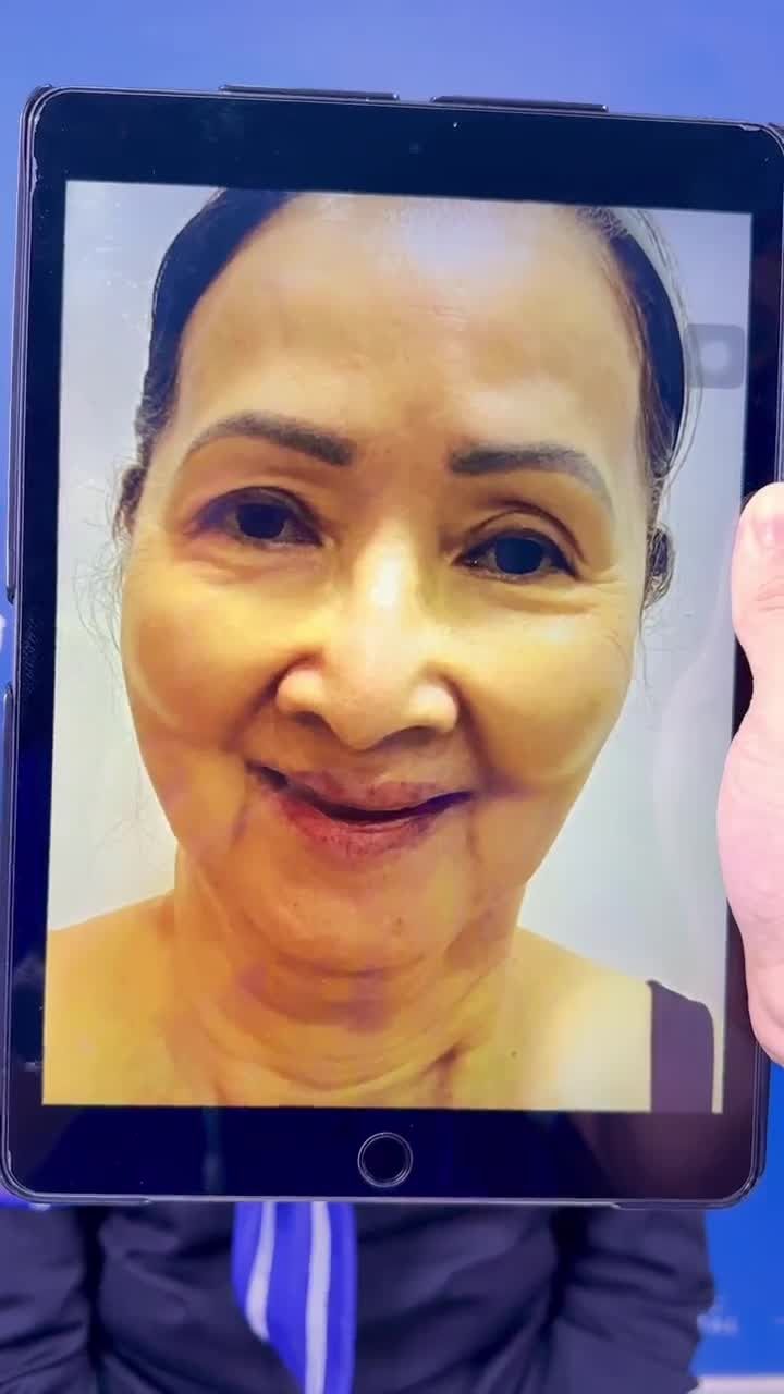 U70 Việt kiều Canada TRẺ NHƯ GÁI 18 an toàn chuẩn y khoa, chồng nhận không ra sau 1 lần thực hiện COMBO CẢI LÃO tại JW