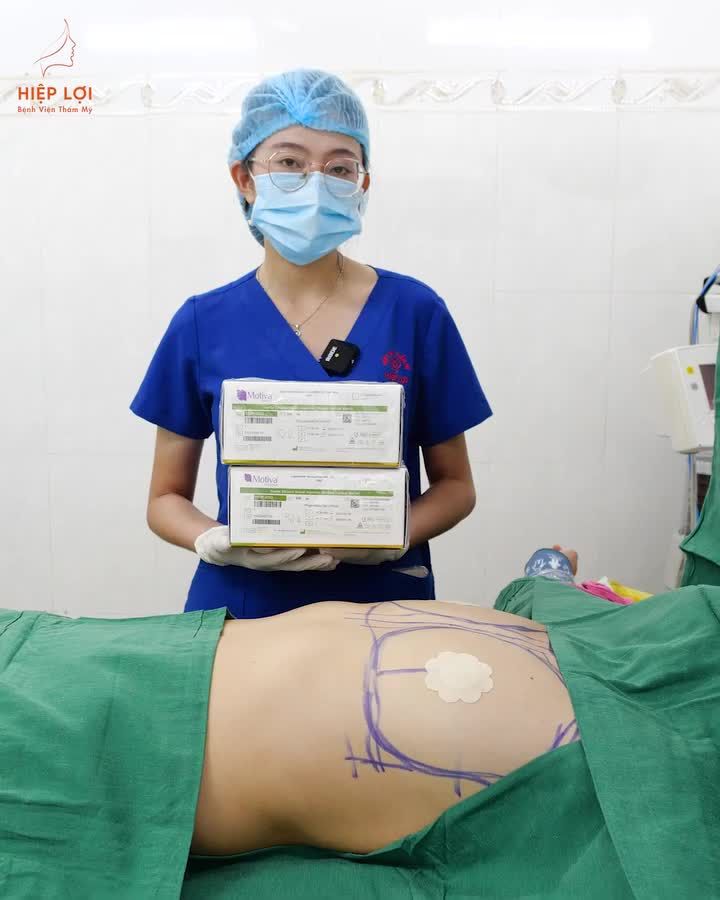 Ca nâng ngực Motiva 335 – 355cc