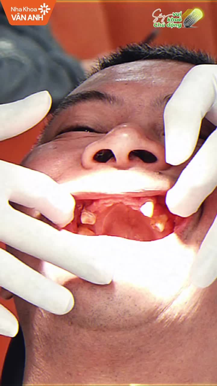 LẮNG NGHE CHIA SẺ CỦA KHÁCH HÀNG TỪ NỖI SỢ MẤT RĂNG