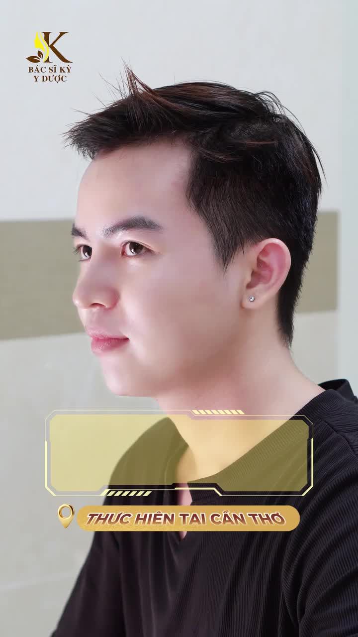 LÀM ĐẸP TINH TẾ – CHUẨN Y KHOA NGAY TẠI CẦN THƠ