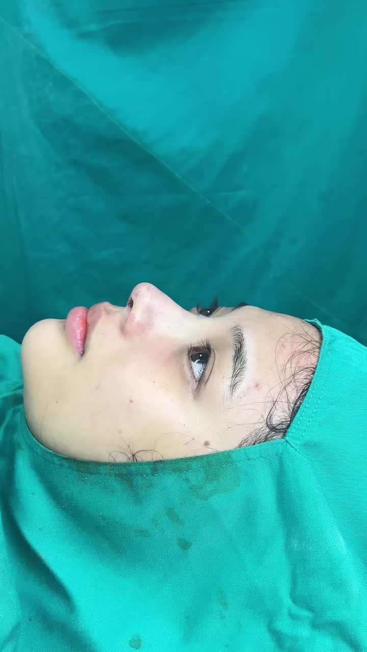 Mũi cấu trúc sau 90 phút nè