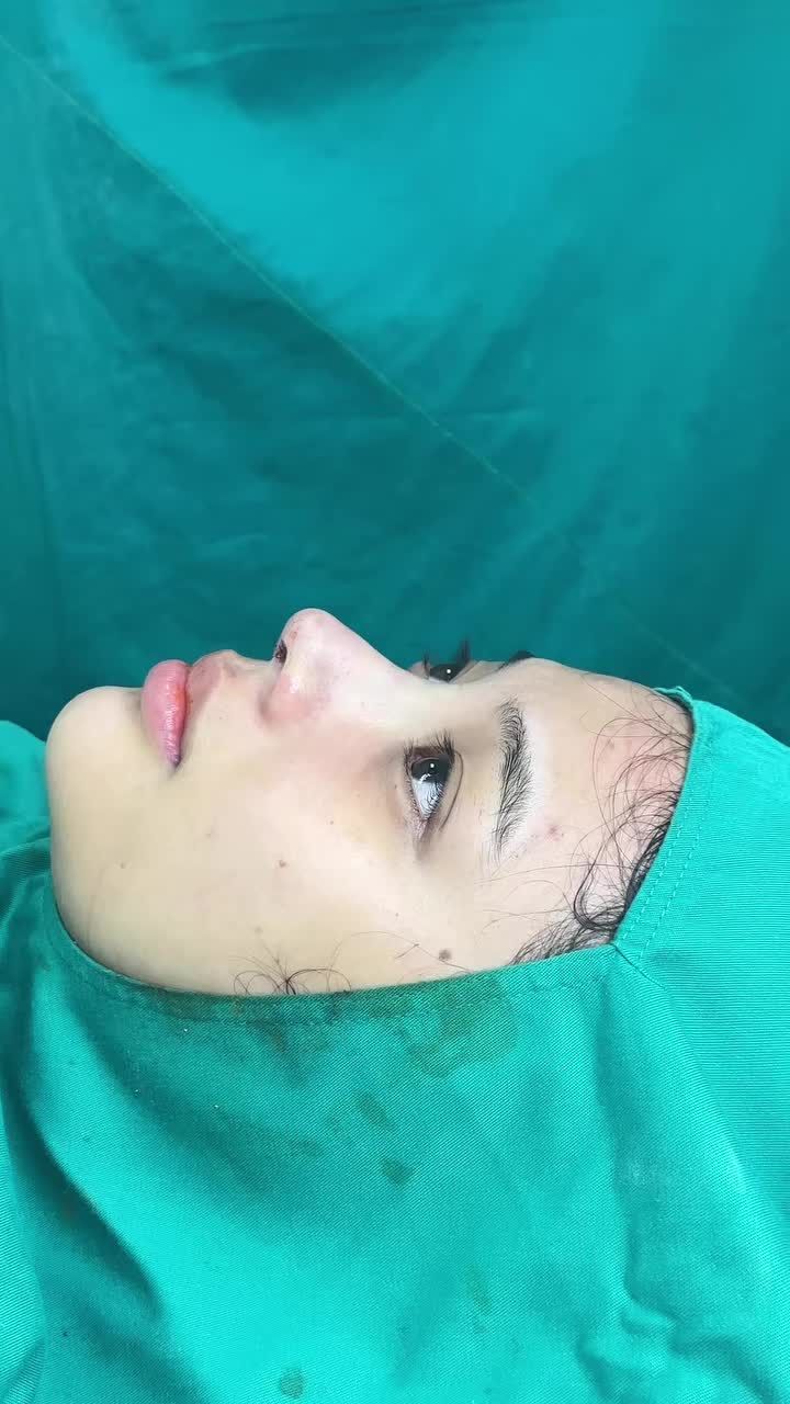 Mũi cấu trúc sau 90 phút nè