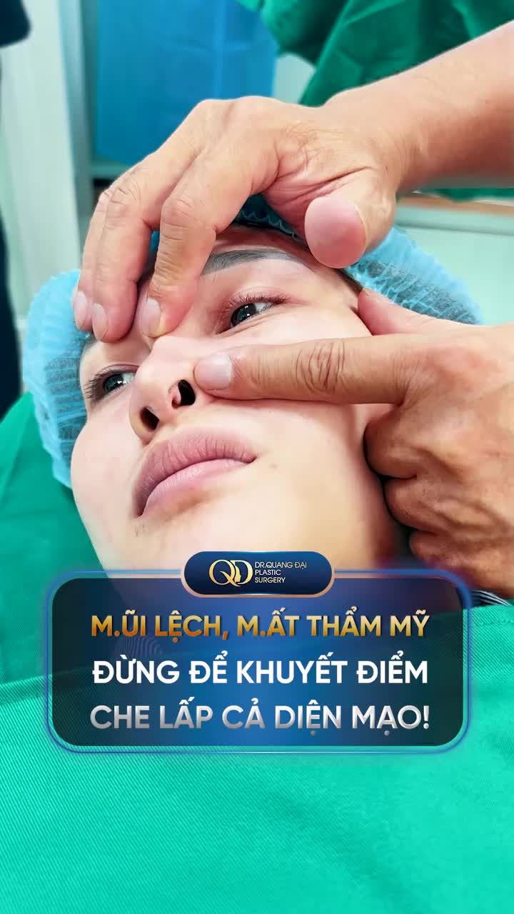MŨI LỆCH, MẤT THẨM MỸ - ĐỪNG ĐỂ KHUYẾT ĐIỂM CHE LẤP CẢ DIỆN MẠO!