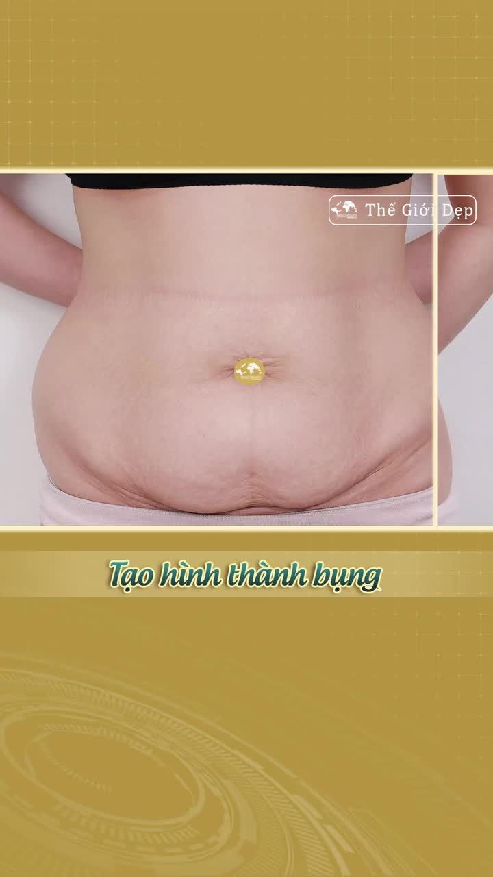Hút mỡ tạo hình thành bụng - Siết eo thon gọn, săn chắc giúp mẹ bỉm 2 con hồi xuân vóc dáng!