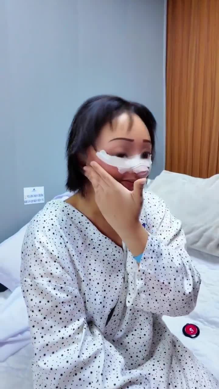 TÁI KHÁM SAU 3 NGÀY PHẪU THUẬT CĂNG DA MẶT TOÀN PHẦN – KHÁCH QUỐC TẾ CHIA SẺ TRẢI NGHIỆM THỰC TẾ