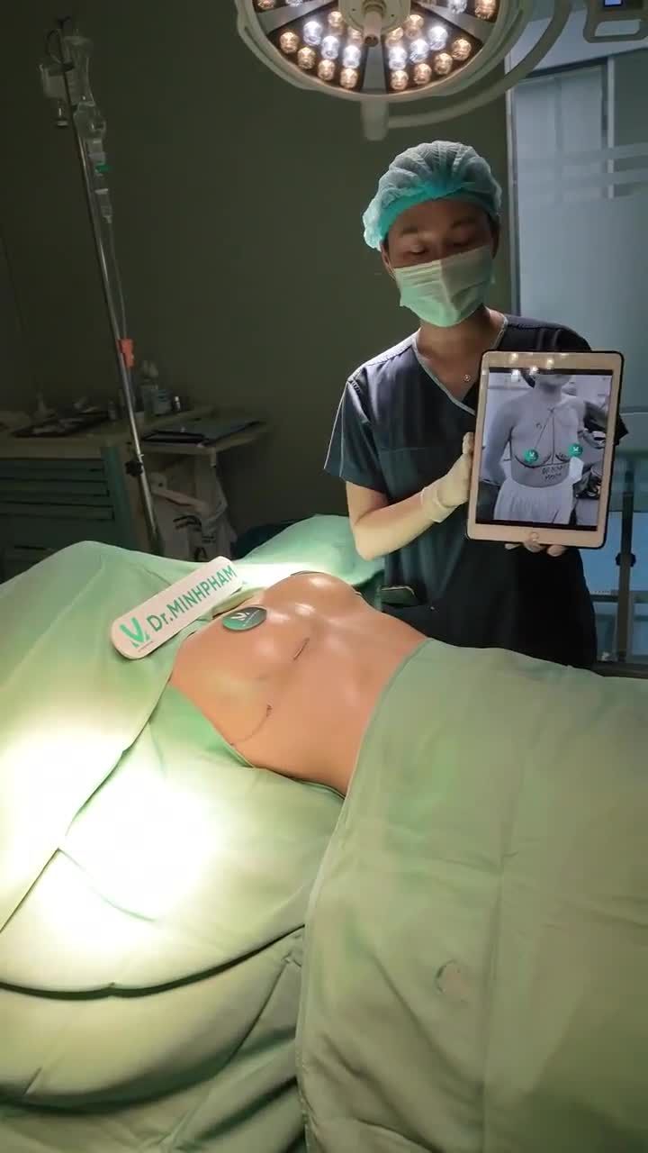 Dòng túi Mentor trơn size 250CC lên form ngay sau khi phẫu thuật