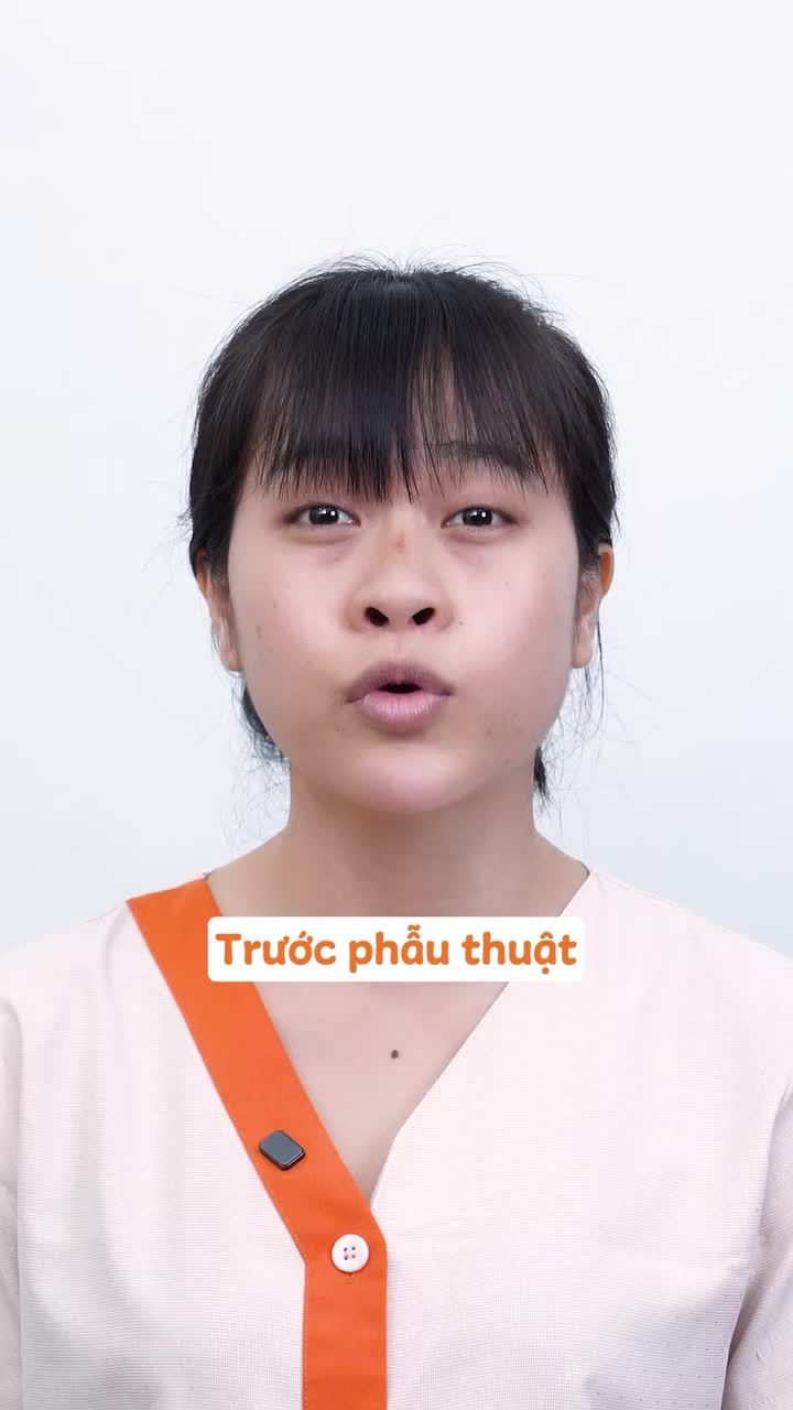 Bạn đang ấp ủ ý định nâng mũi? Đừng lướt qua video này vì đây chính là tín hiệu vũ trụ gửi đến bạn!!