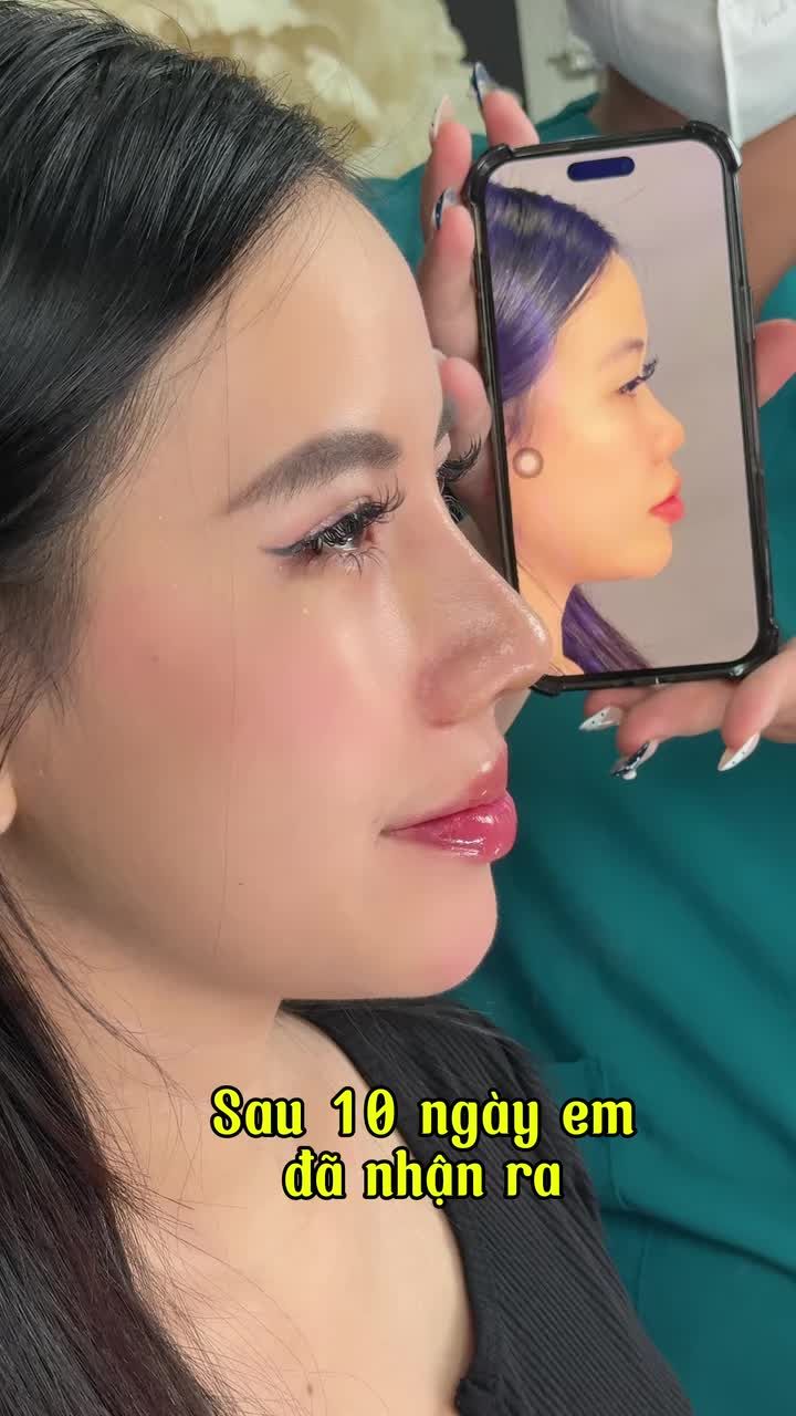Mũi 10 ngày đẹp cỡ này thui nè!!