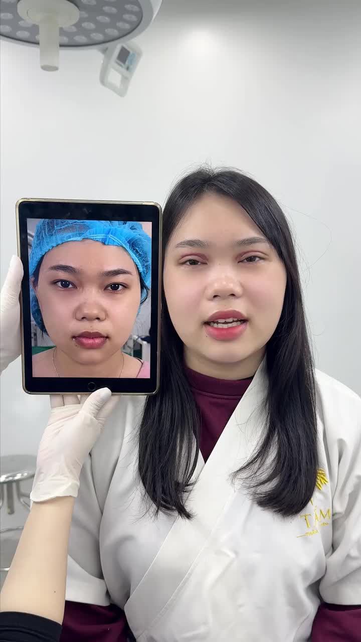 “Không nghĩ sau 1 tuần mà đã đỡ bầm như này rồi ạ!”