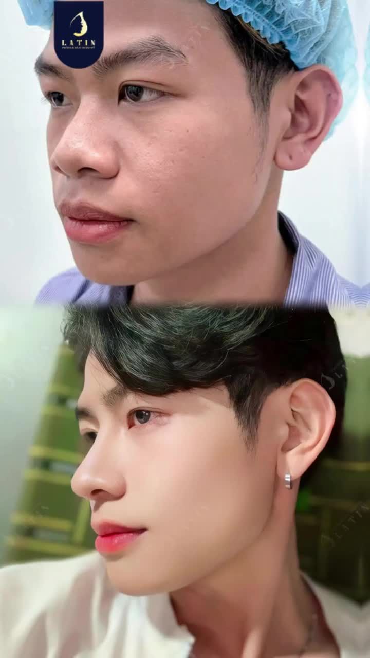 DÁNG MŨI NAM TÍNH - MUÔN PHẦN TỰ TIN