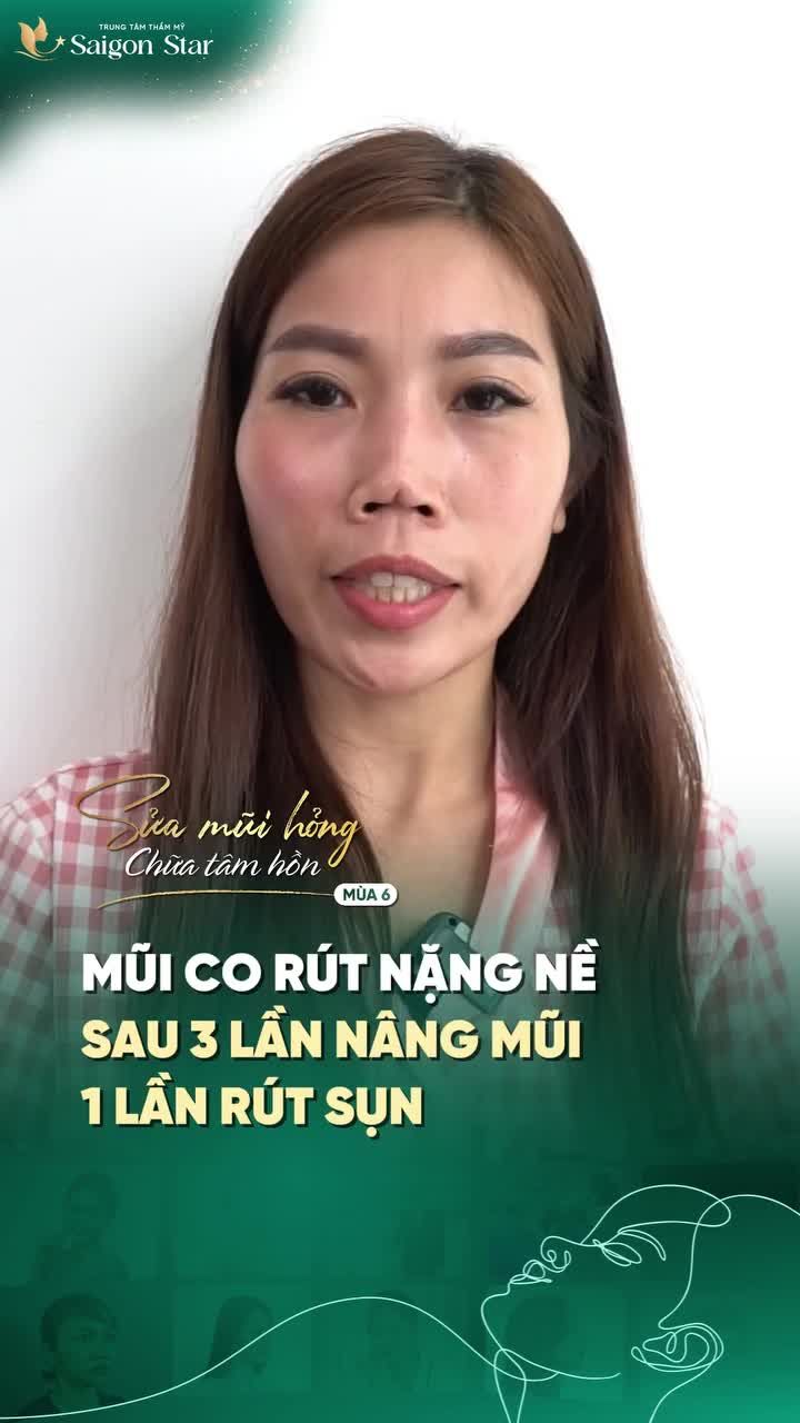 NỮ VIỆT KIỀU ĐÀI LOAN GẶP BIẾN CHỨNG NẶNG SAU 3 LẦN NÂNG MŨI THẤT BẠI!!!!