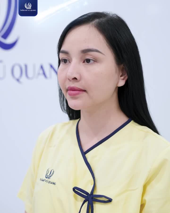 NÂNG MŨI KHÔNG ĐAU - BỀN ĐẸP CẢ THẬP KỶ