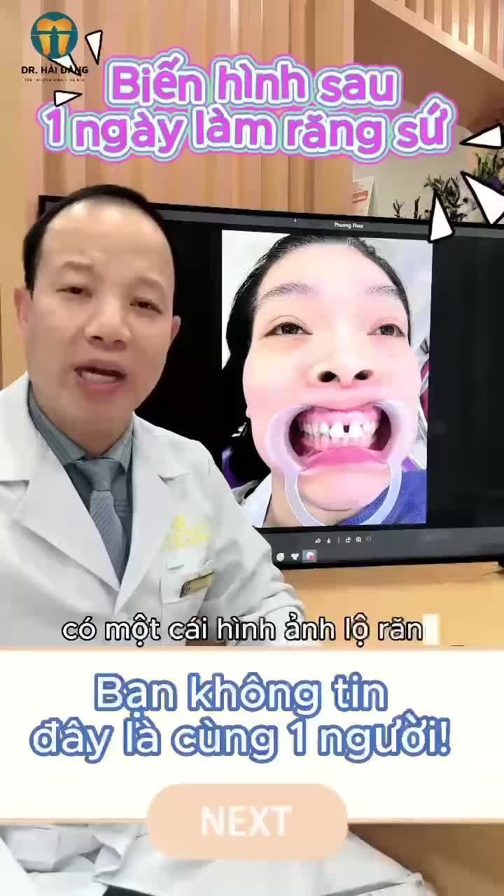 RĂNG THƯA ĐỪNG ĐỂ TIỀN RA NHƯ NƯỚC KHẮC PHỤC ĐIỀU TRỊ KHE THƯA   TẠI NHA KHOA HẢI ĐĂNG