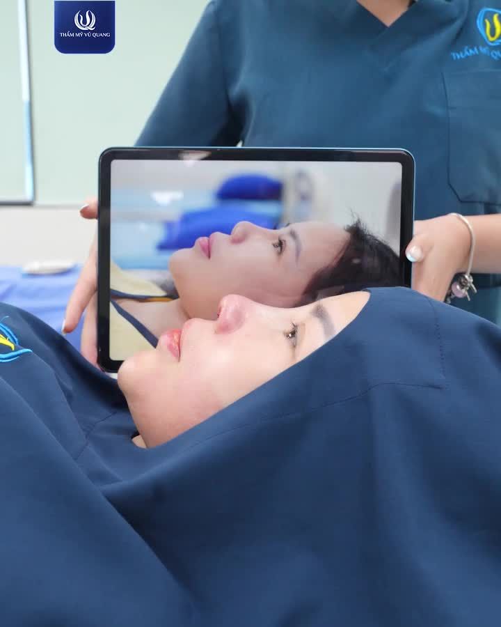Liệu rằng kết quả sau sửa mũi tại Thẩm mỹ Vũ Quang như thế nào? Có đúng như những gì chị khách của chúng ta đã kì vọng?