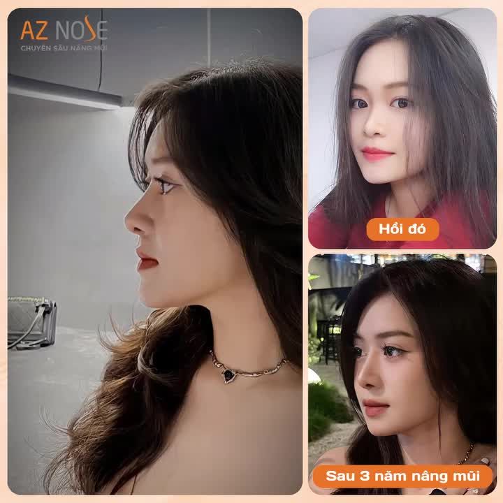 GenZ chọn đầu tư sớm vào ngoại hình để tự tin phát triển bản thân. Bạn đã sẵn sàng thay đổi