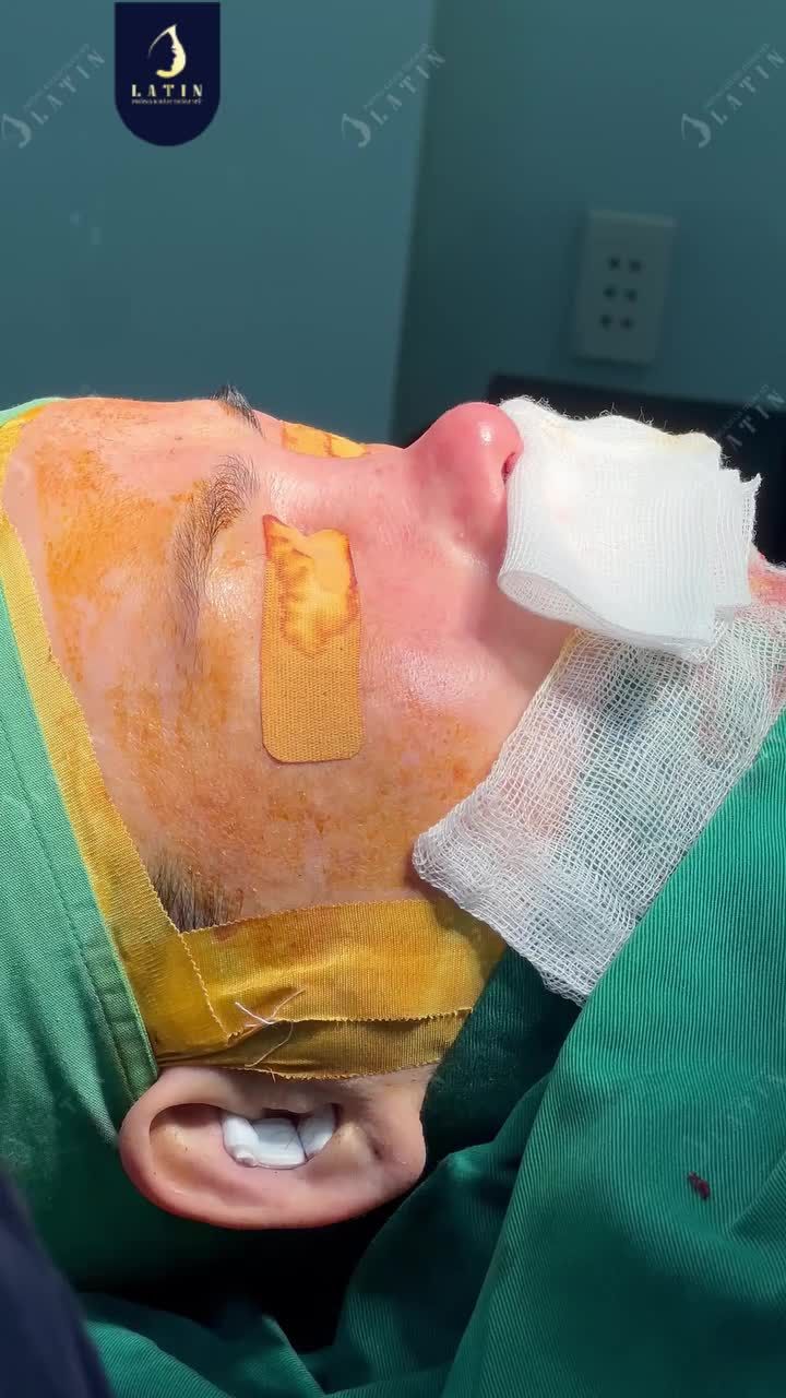 MỘT NƯỚC ĐI - VẠN DẶM ƯNG Ý