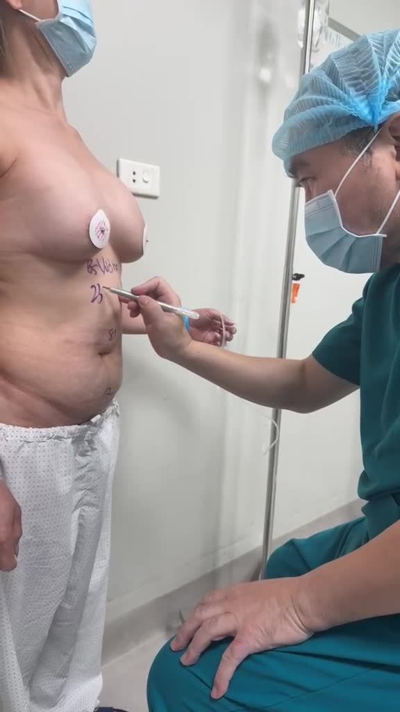 Dr Vương tư vấn hút mỡ bụng (bụng trên-dưới phía trước và hông eo phía sau), hút mỡ lưng, … cho bạn gái Việt kiều từ Cộng hoà Séc về VN !