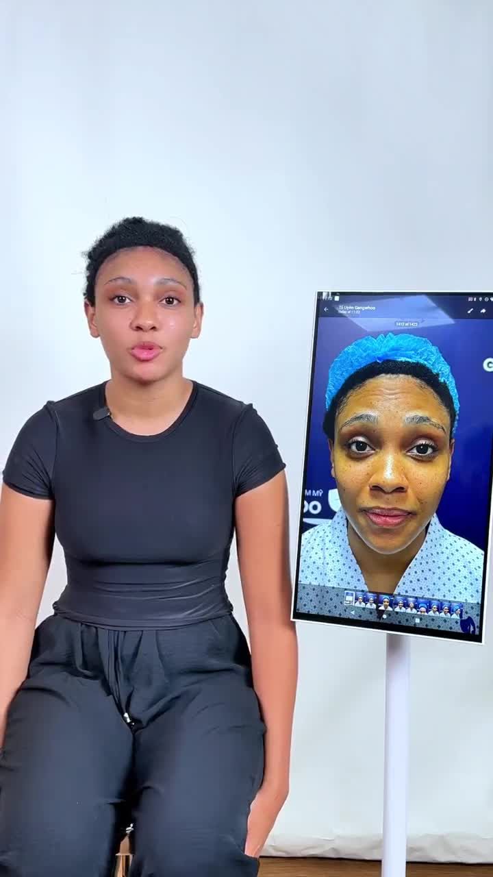 KHÁCH HÀNG ĐẾN TỪ HAWAII (MỸ) THỰC HIỆN DỊCH VỤ HẠ ĐƯỜNG CHÂN TÓC TẠI BỆNH VIỆN THẨM MỸ GANGWHOO