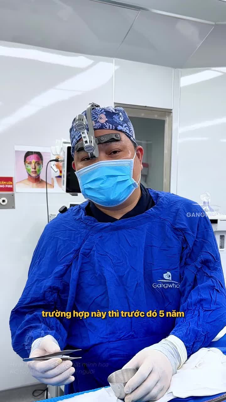 Nâng mũi sụn sườn có phải là vĩnh viễn?