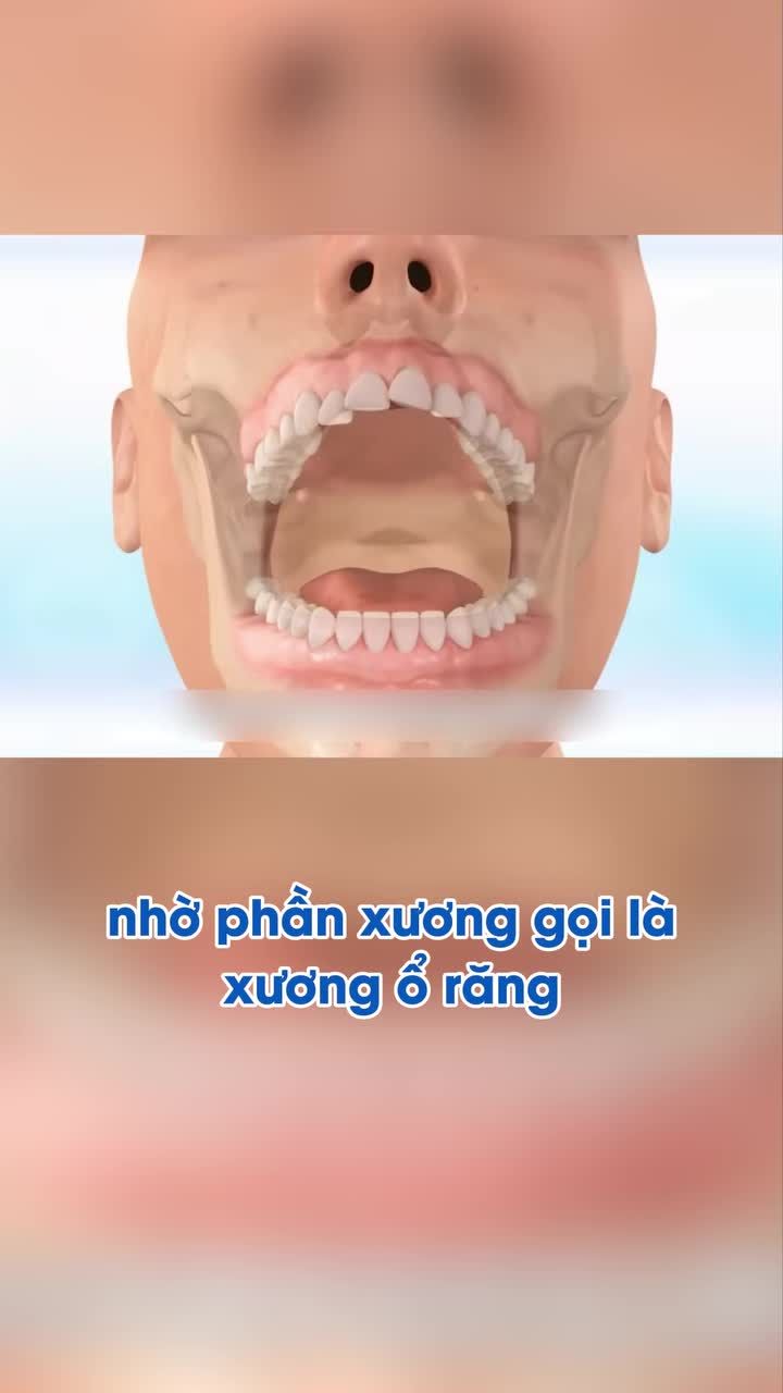 Quá trình niềng răng mắc cài