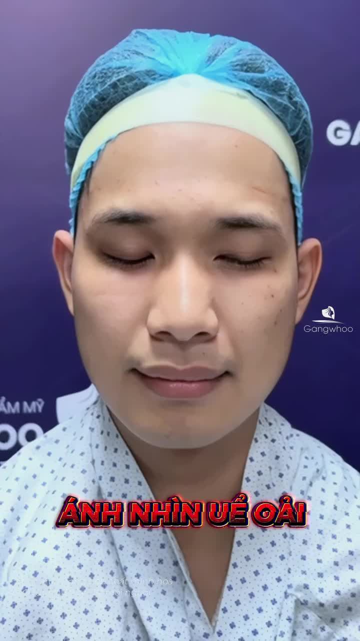 Kết quả rõ rệt sau 1 tháng điều trị chỉnh sụp cơ nâng mi, khách hàng hài lòng với dịch vụ tại Gangwhoo