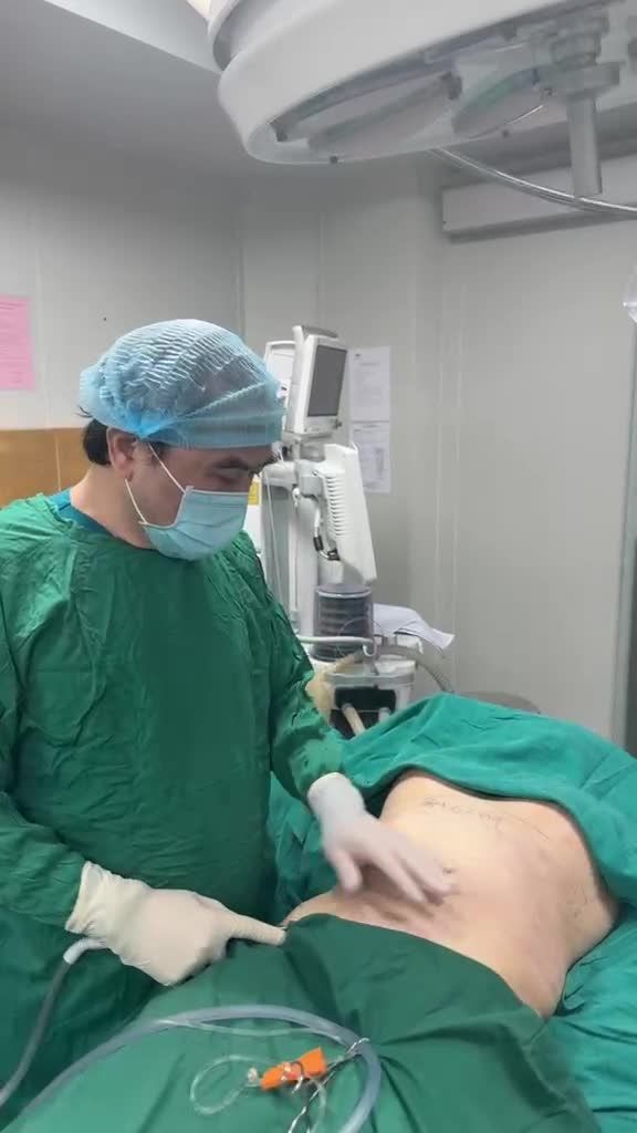 HÚT MỠ BỤNG VỚI DR VƯƠNG