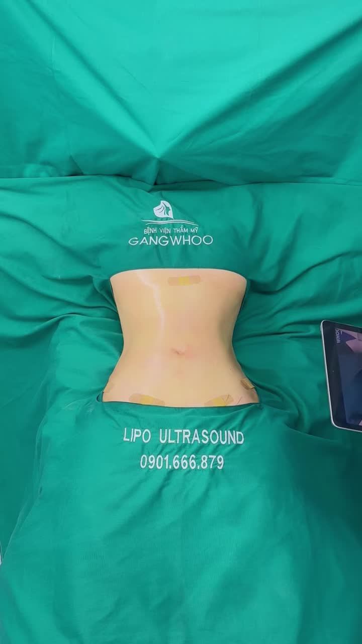 MC BẬT MÍ CÔNG NGHỆ LIPO ULTRASOUND: LẤY SẠCH MỠ BỤNG SAU SINH NHẸ NHÀNG TẠI GANGWHOO!