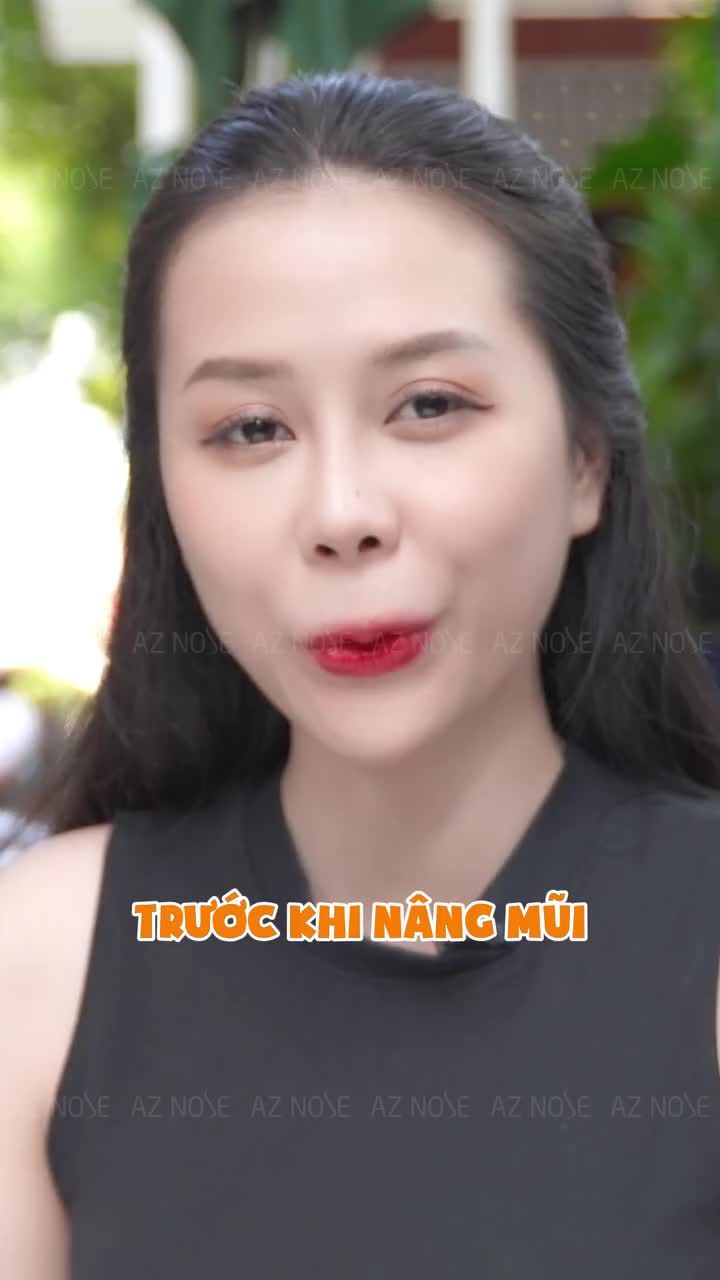 Top 50 MGV 2022 - Đặng Thị Tứ thay đổi thế nào sau 6 tháng tái tạo mũi h..ỏng?