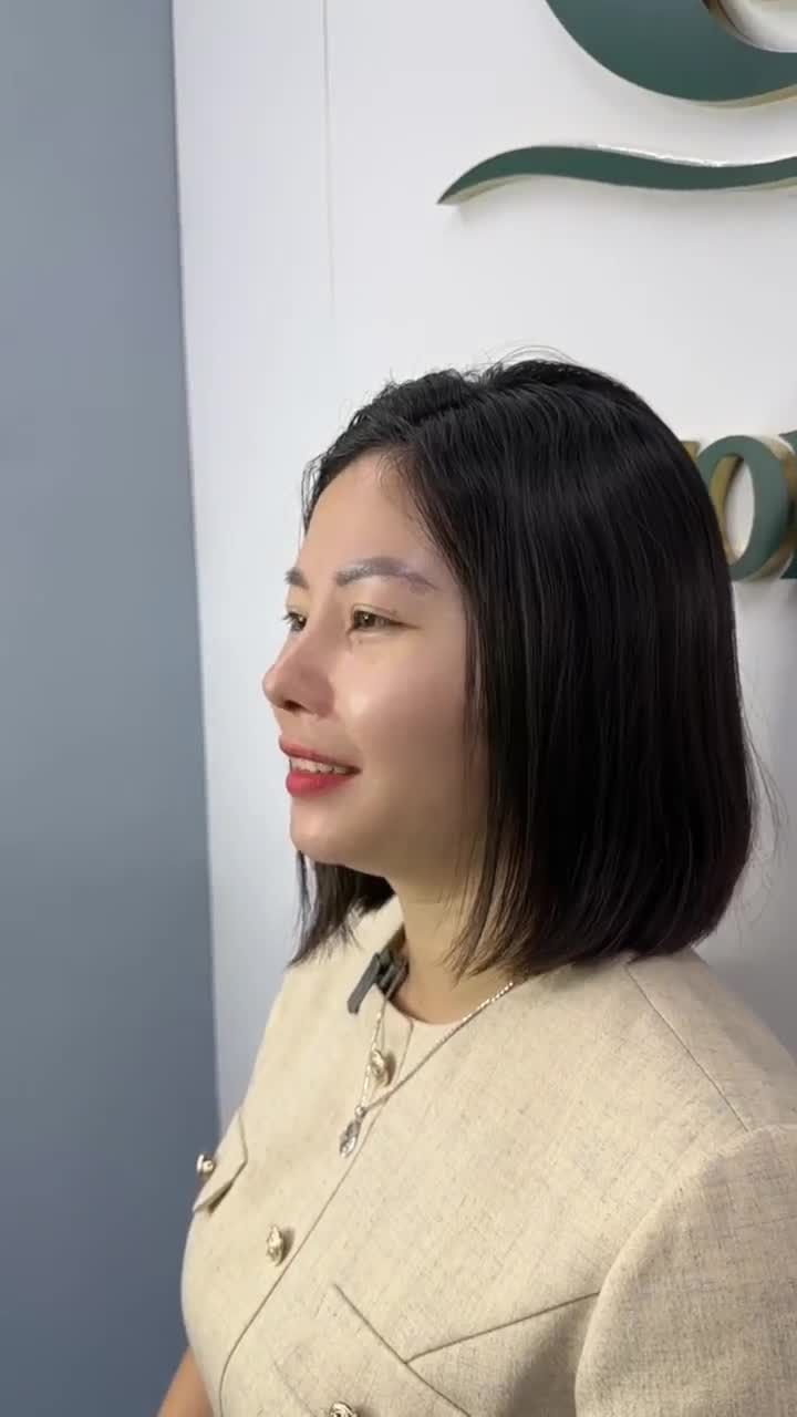 KẾT QUẢ SAU 10 NGÀY NÂNG MŨI CẤU TRÚC