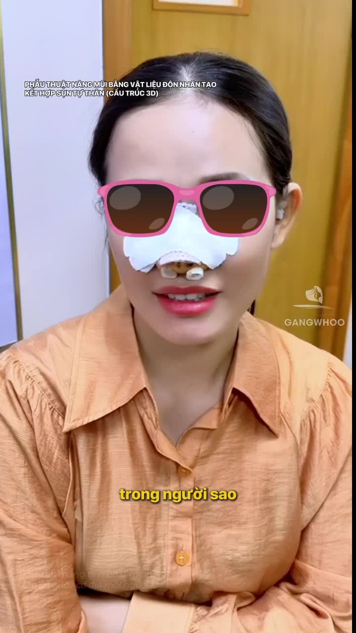Khách hàng nói gì sau khi nâng mũi tại BVTM Gangwhoo. Phẫu thuật nâng mũi bằng vật liệu độn nhân tạo kết hợp sụn tự thân (cấu trúc 3D)