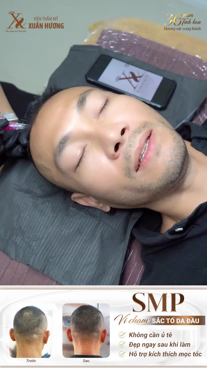 “Anh hoàn toàn không thấy đau!”