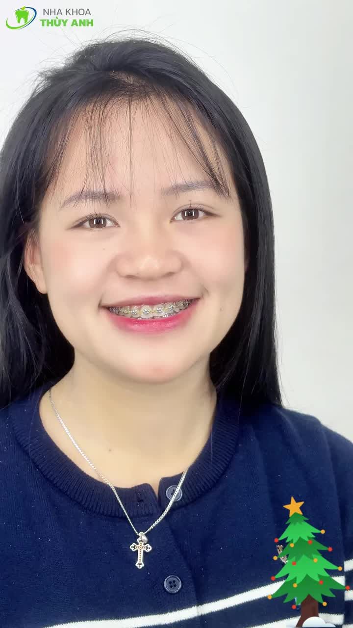 Tháo mắc cài đúng mùa Noel… Nụ cười mới toanh, lên hình auto sáng!