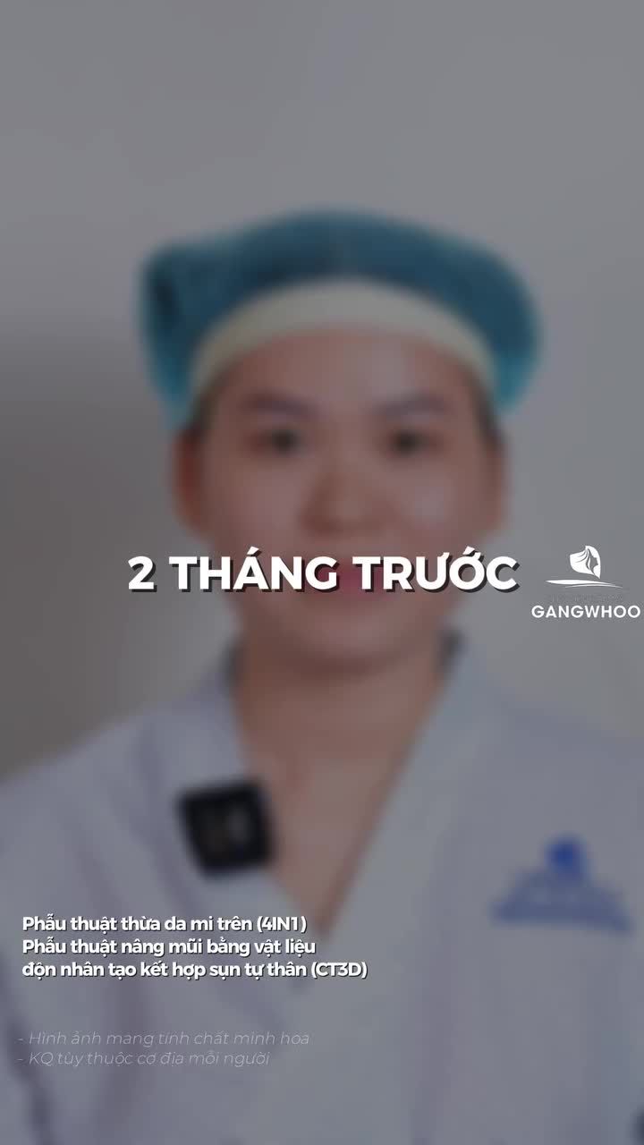 Thăng hạng nhan sắc nhờ combo mắt mũi. Khi bạn tự tin hơn trong cuộc sống, may mắn cũng tự khắc ghé qua.