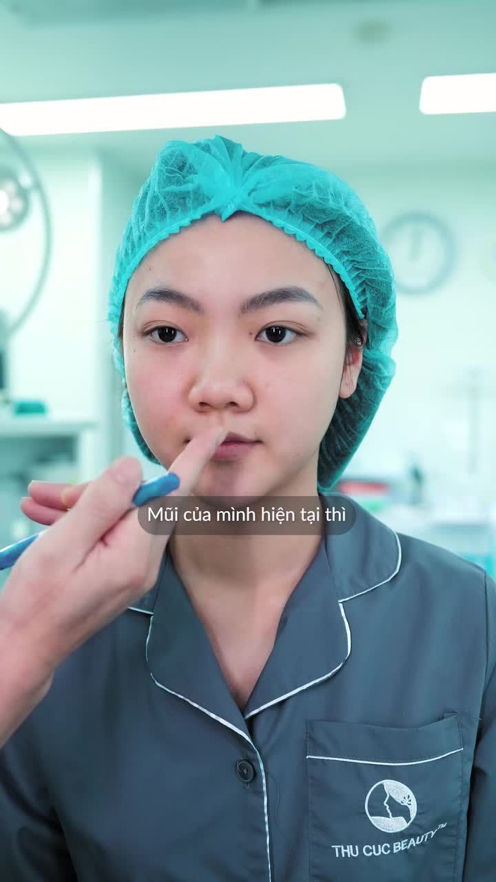 XÓA SỔ MŨI TẸT – ĐỔI LẤY SỰ TỰ TIN CHO EM SINH VIÊN NĂM 2