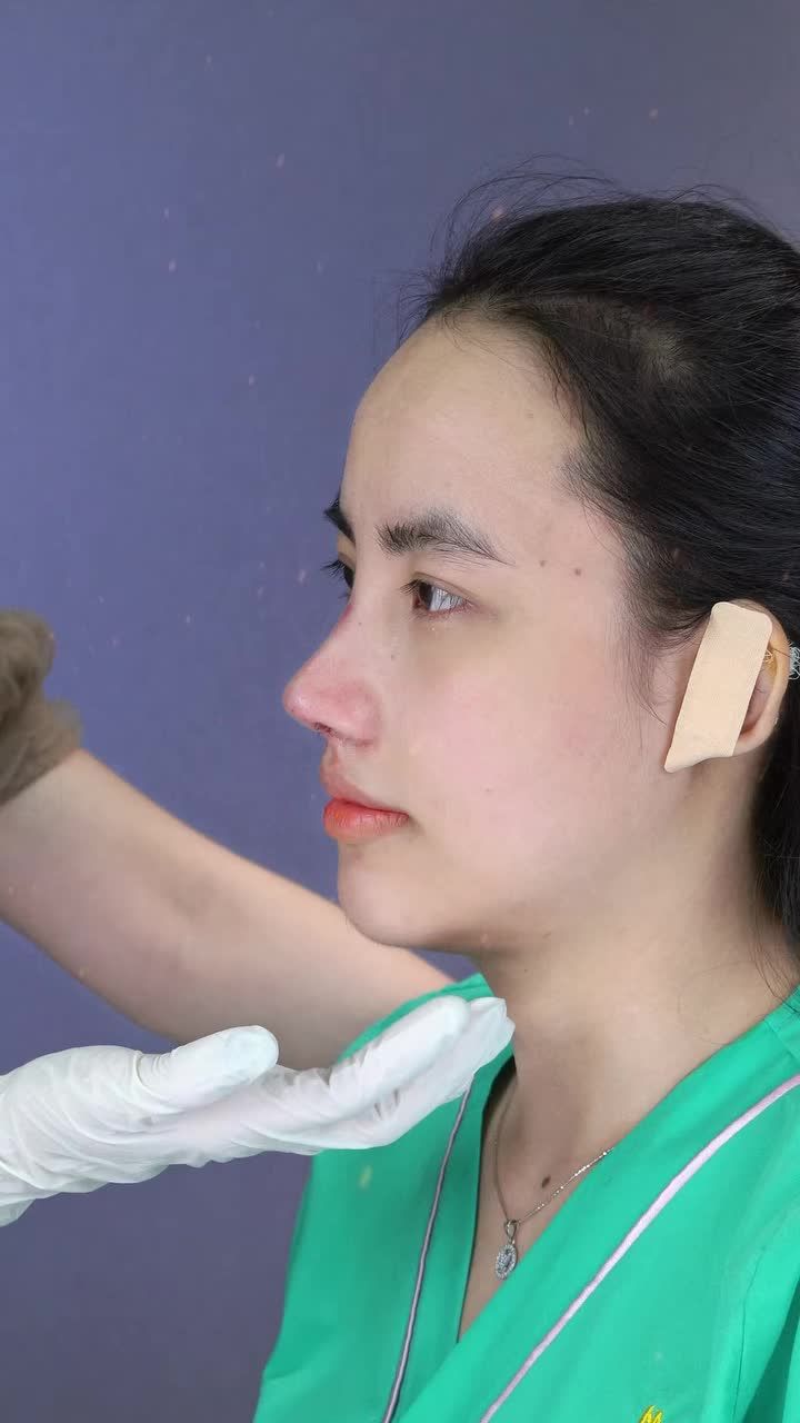 Chọn đúng địa chỉ làm đẹp sở hữu ngay dáng mũi bền đẹp dài lâu!!