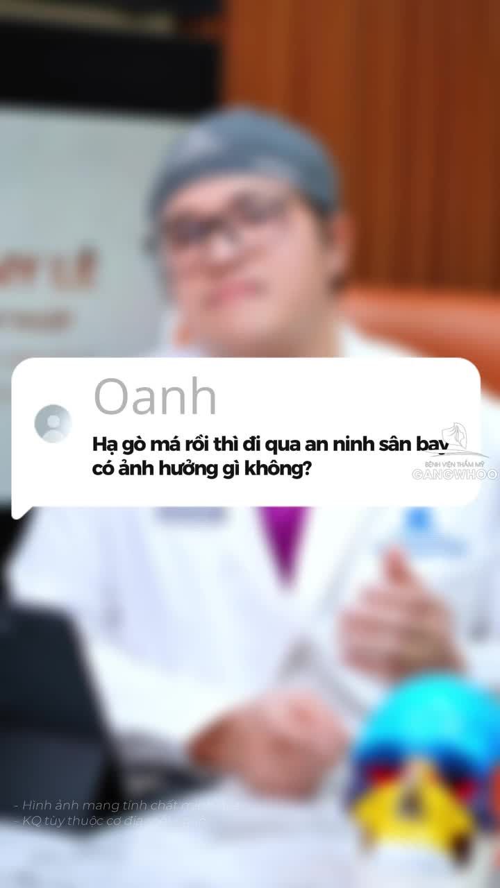 DMKT: Phẫu thuật chỉnh  sửa gò má - cung tiếp