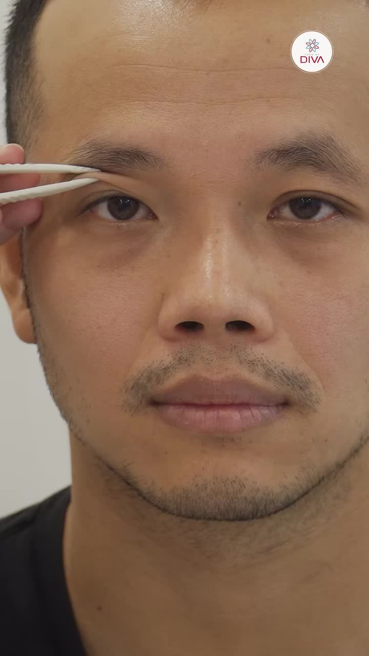 4 BƯỚC BẠN CẦN BIẾT ĐỂ CÓ ĐƯỢC KẾT QUẢ NHƯ MONG MUỐN KHI ĐI LÀM ĐẸP VÙNG MẮT!