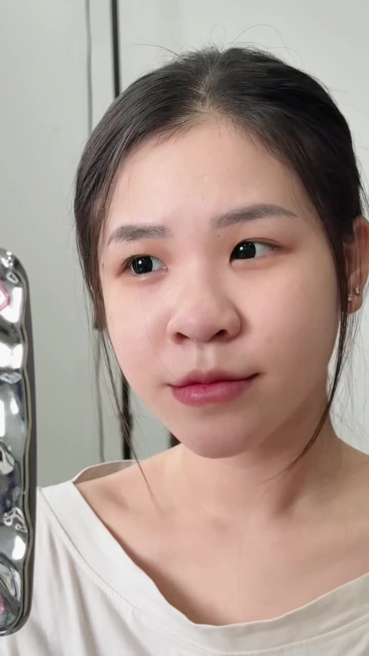 Mũi siêu thấp tẹt cao đẹp tự nhiên chỉ sau 90 phút!!
