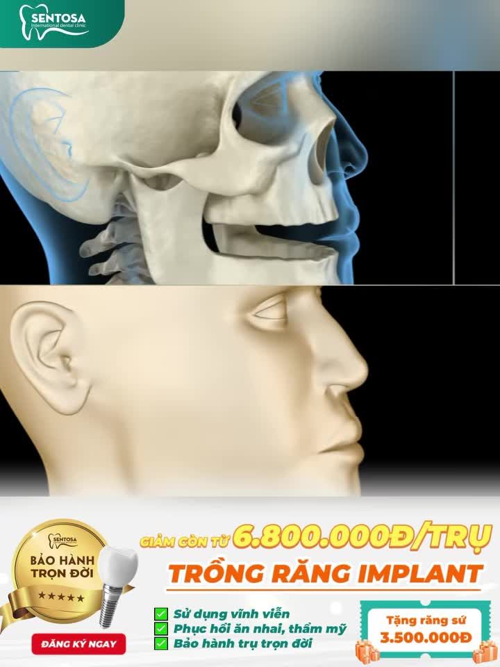 MỘT HAY NHIỀU CHIẾC RĂNG BỊ MẤT - CẢ HÀM PHẢI GÁNH HẬU QUẢ