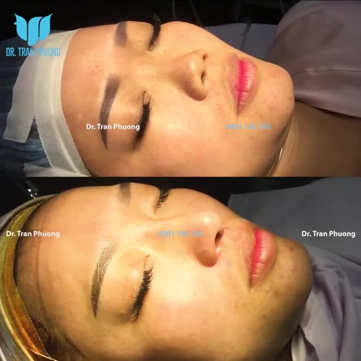 60 PHÚT CHO MỘT SỰ THAY ĐỔI. CÁC BẠN THẤY CÓ ĐÁNG KHÔNG?