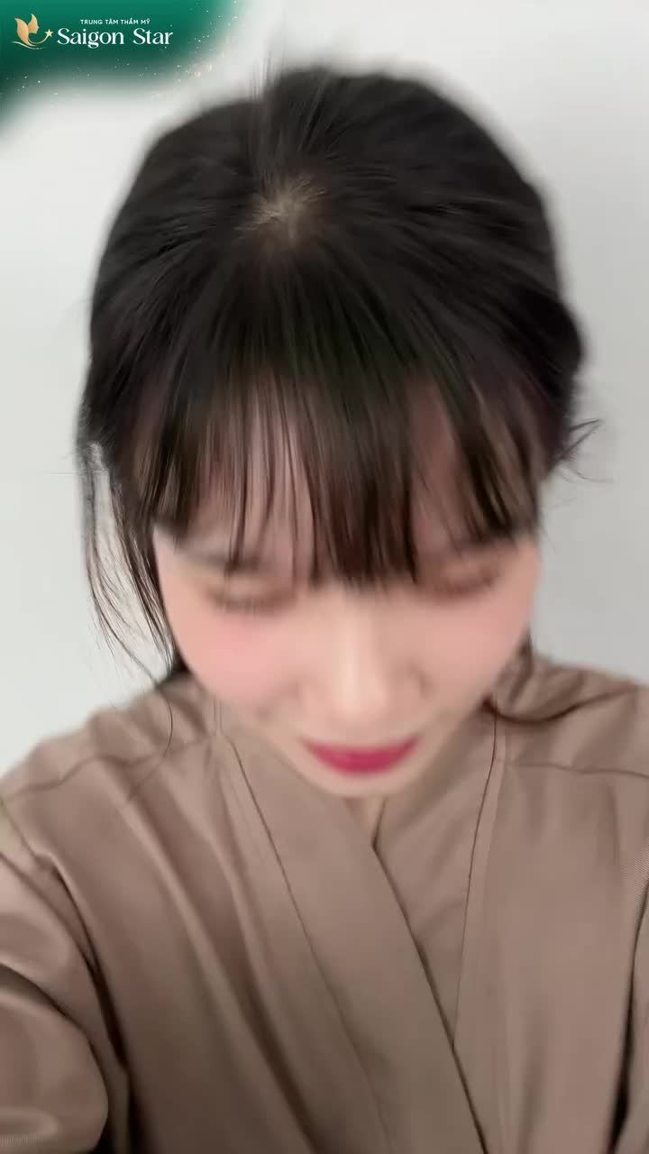 KHÁCH HÀNG "ĐẸP DỊU" RẠNG RỠ SAU 3 THÁNG NÂNG MŨI CẤU TRÚC