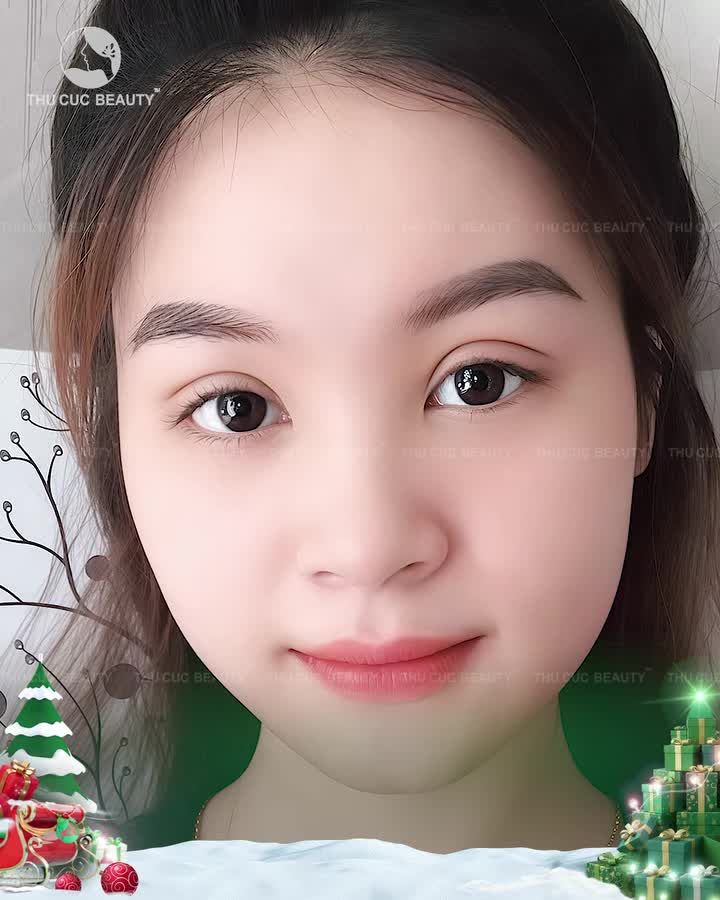 Trả lời thắc mắc khách hàng Nhan sắc sau cắt mí thăng hạng như nào?