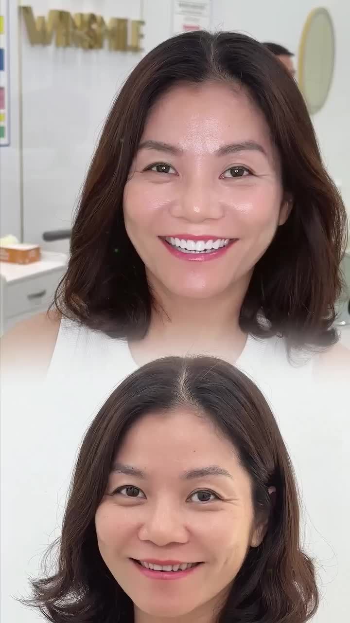 Đánh thức nét đẹp sắc sảo, nâng tầm diện mạo thăng hoa