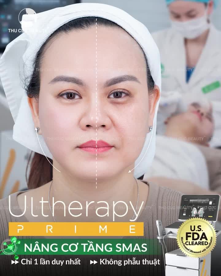 Ultherapy Prime - Đỉnh cao nâng cơ chuyên sâu thế hệ mới