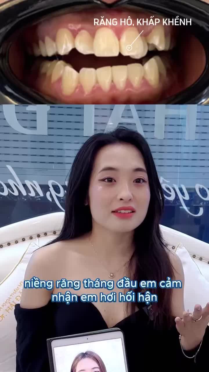 NIỀNG RĂNG KHÔNG ĐAU NHƯ BẠN NGHĨ