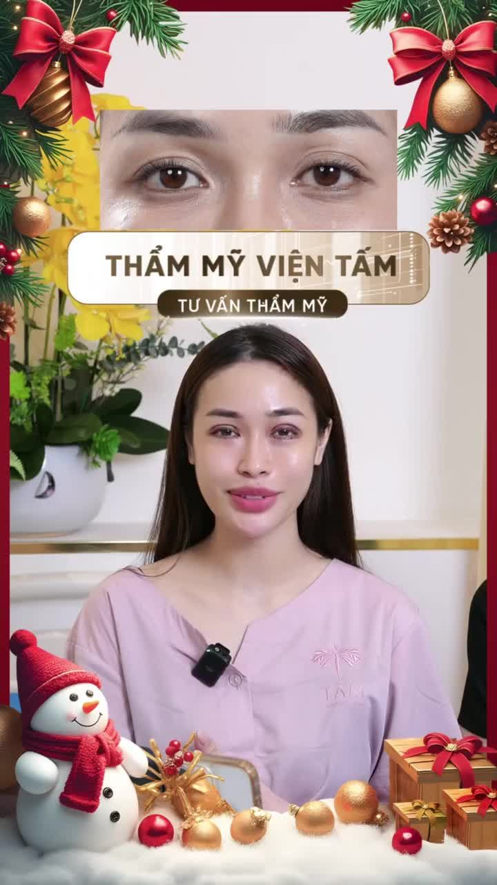 Bạn Nhung chia sẻ: Ban đầu chỉ làm mí trên, nhưng sau khi thăm khám, mình đã mạnh dạn làm full combo mí trên và mí dưới.