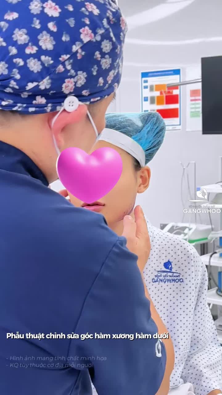 GỌT HÀM NỘI SOI – TÁI ĐỊNH HÌNH CHUẨN MỊN