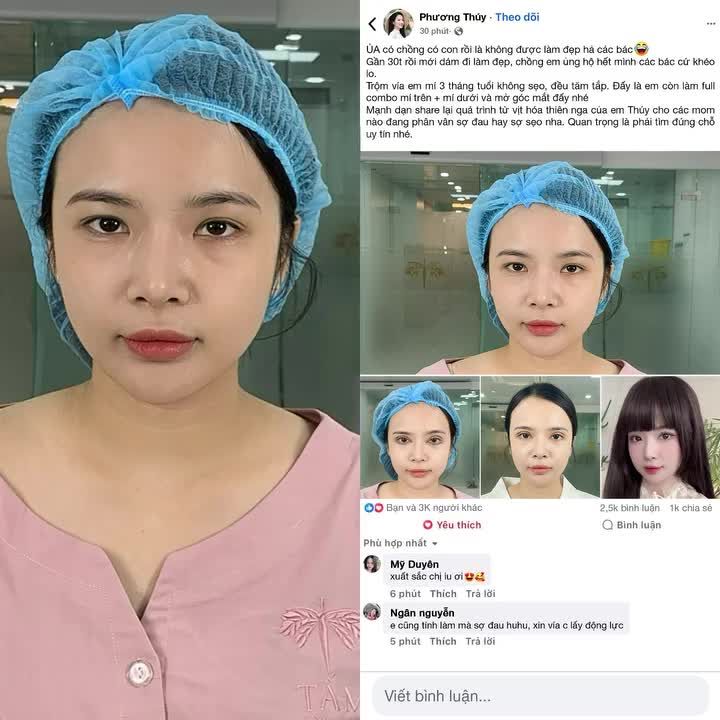 Chiếc mí xinh yêu và màn lột xác ngoạn mục của chị Phương Thúy