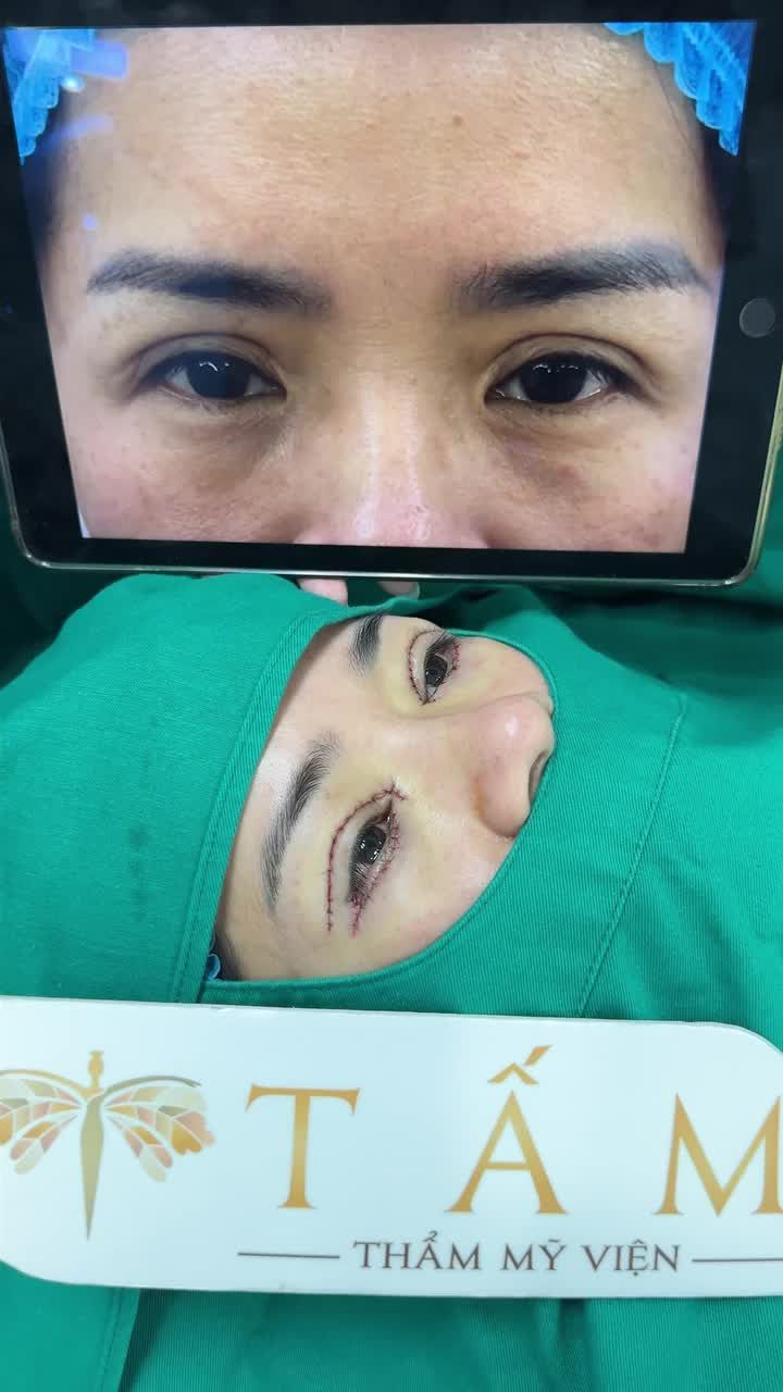 "Chị đi các cơ sở khác, bác sĩ chỉ cắt thôi nhưng bác ở đây làm hết nên là yên tâm lắm!"